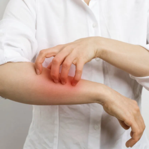 Home Allergy Testing Services in Dubai